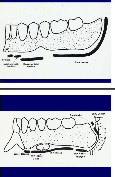 <p>the muscles that attach into the bone around the sulcus area</p><p>if the denture is too long in those areas - the muscle attachments will press onto edges of denture</p><p>push denture out</p><p>rubbing - pain</p><p>there are structures underneath you don’t want to press on</p>