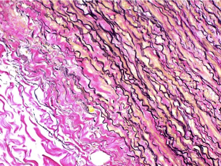 <p>What connective tissue fiber is shown in the following image?</p>