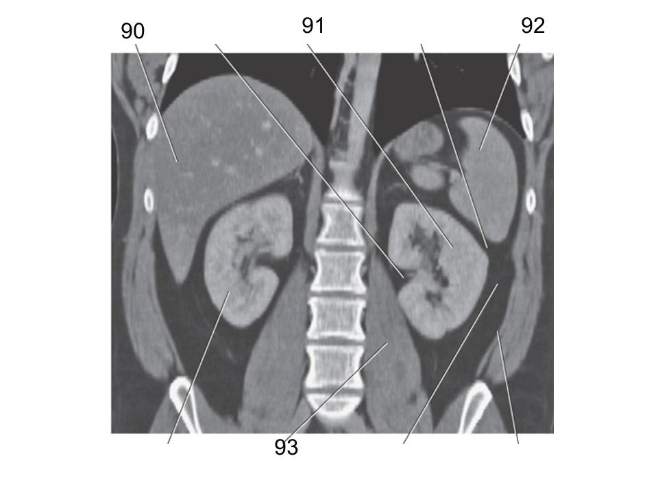 <p>92</p>