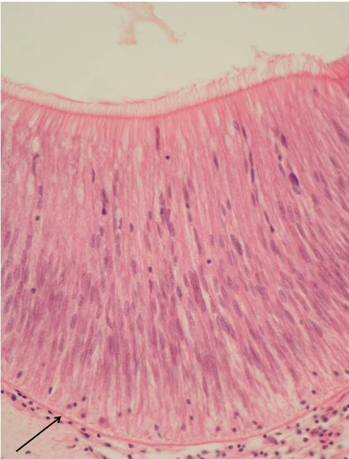 term image