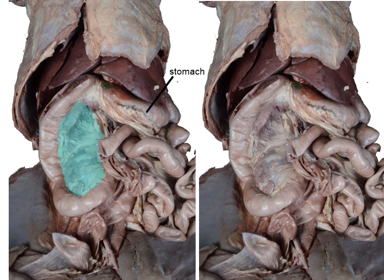 <p>The peritoneal/mesenteric structure highlighted in blue in the left image is part of the</p>