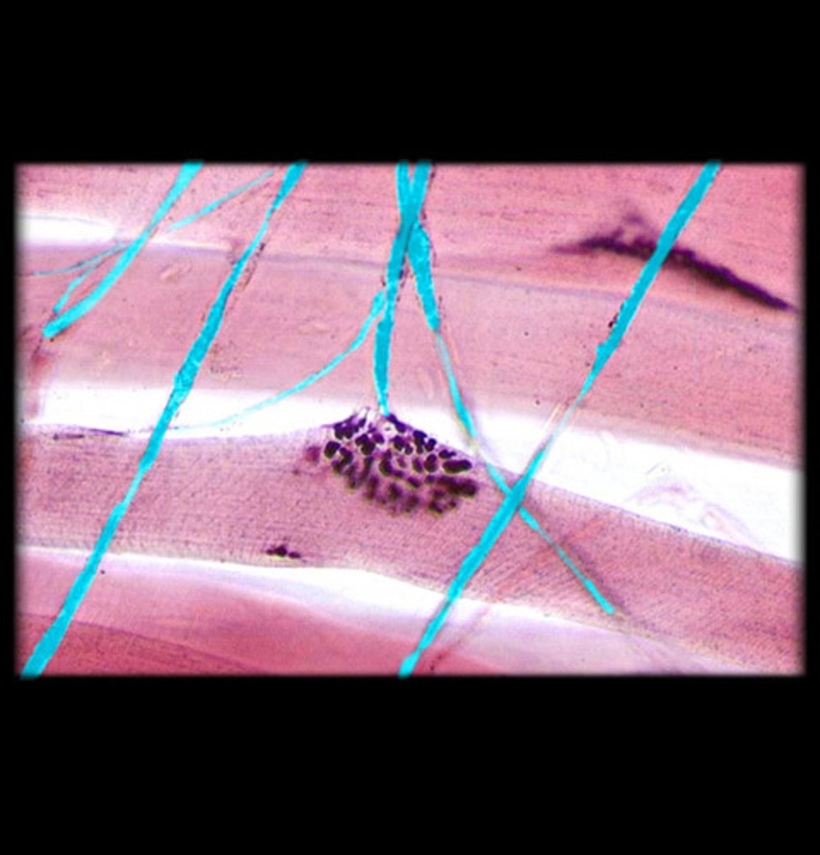 <p>• branch of efferent motor neuron</p><p>• carries wave of depolarization to muscle</p>