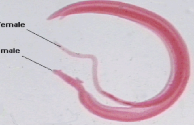 <p><strong><em>Schistosoma mansoni</em></strong><em> —</em></p><ul><li><p>What <strong>category&nbsp;</strong>does it belong to?</p></li><li><p>What kind of <strong>reproduction method</strong> does it have?</p></li><li><p>What <strong>disease </strong>does it cause?&nbsp;</p></li></ul><p></p>