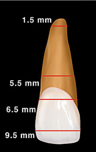 <p><strong><span style="font-family: Times New Roman, serif">Mesial to distal measurements, there can be a variety of placements. WIDEST POINT - CEJ – APEX. Decide where you want to measure, then measure all the teeth accordingly.</span></strong></p>