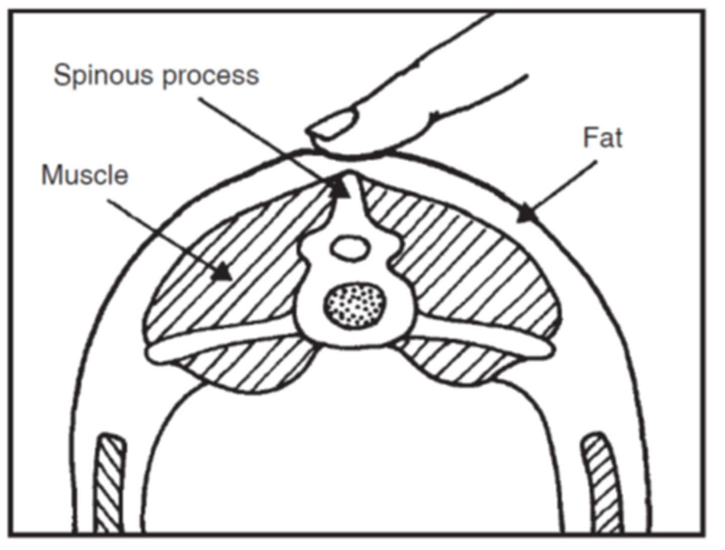 <p>YES- must touch lumbar region, feel for transverse processes</p>