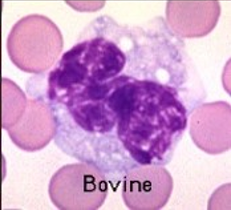 <p><span>This cell has nonstaining areas within its cytoplasm that are called vacuoles. This is the largest of the WBCs and is usually increased when parasitic or fungal infections are present.&nbsp;What is the name of this WBC?</span></p>