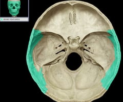 <p>Identify the bone.</p>