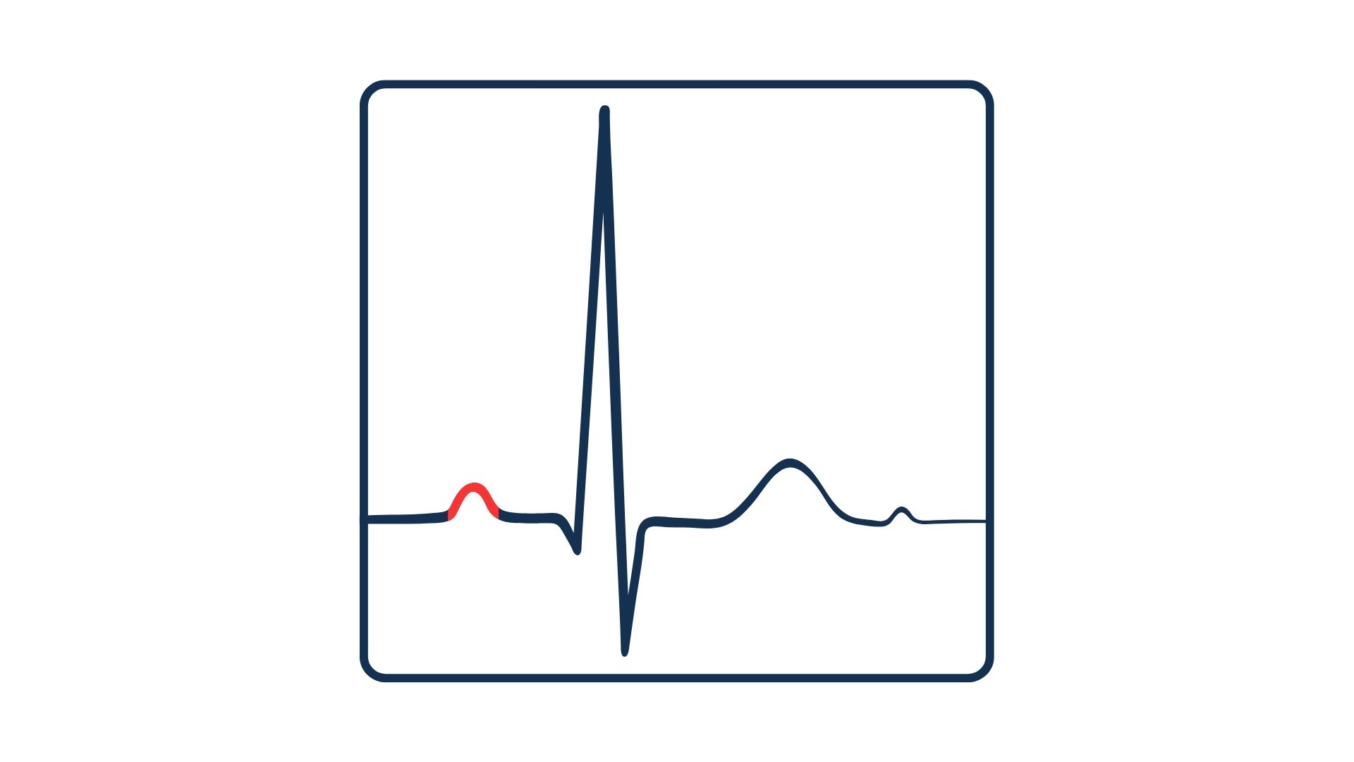 <p>What is the segment highlighted in red</p>
