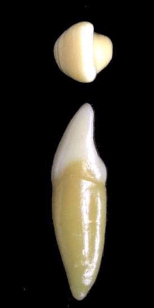 <p>what tooth is this &amp; why?</p>