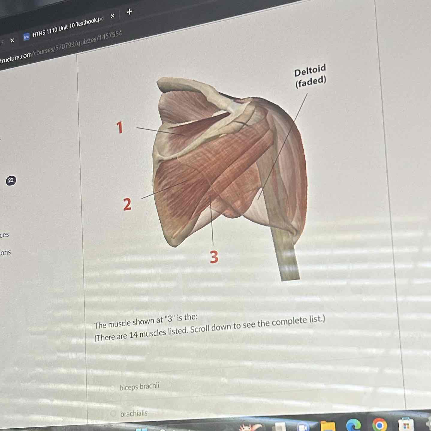<p>The muscle shown at 3  is the</p>
