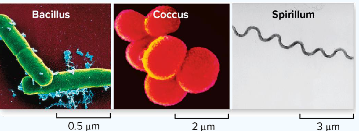 <ul><li><p>bacillus</p></li><li><p>coccus </p></li><li><p>spirillum</p></li></ul><p></p>