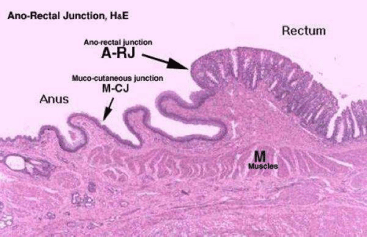 <p>The simple columnar epithelium of the rectum changes abruptly to nonkeratinized stratified squamous epithelium.</p>
