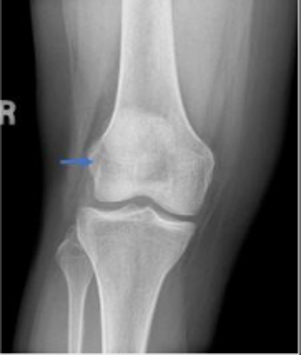 <p>What is the arrow pointing to?</p>