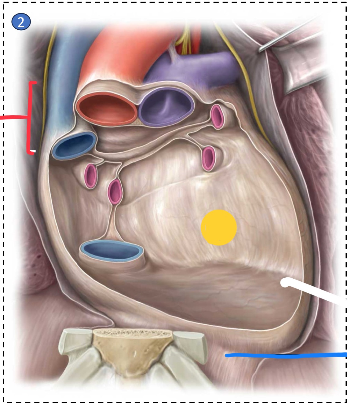 <p>What structure is identified by the red line?</p>