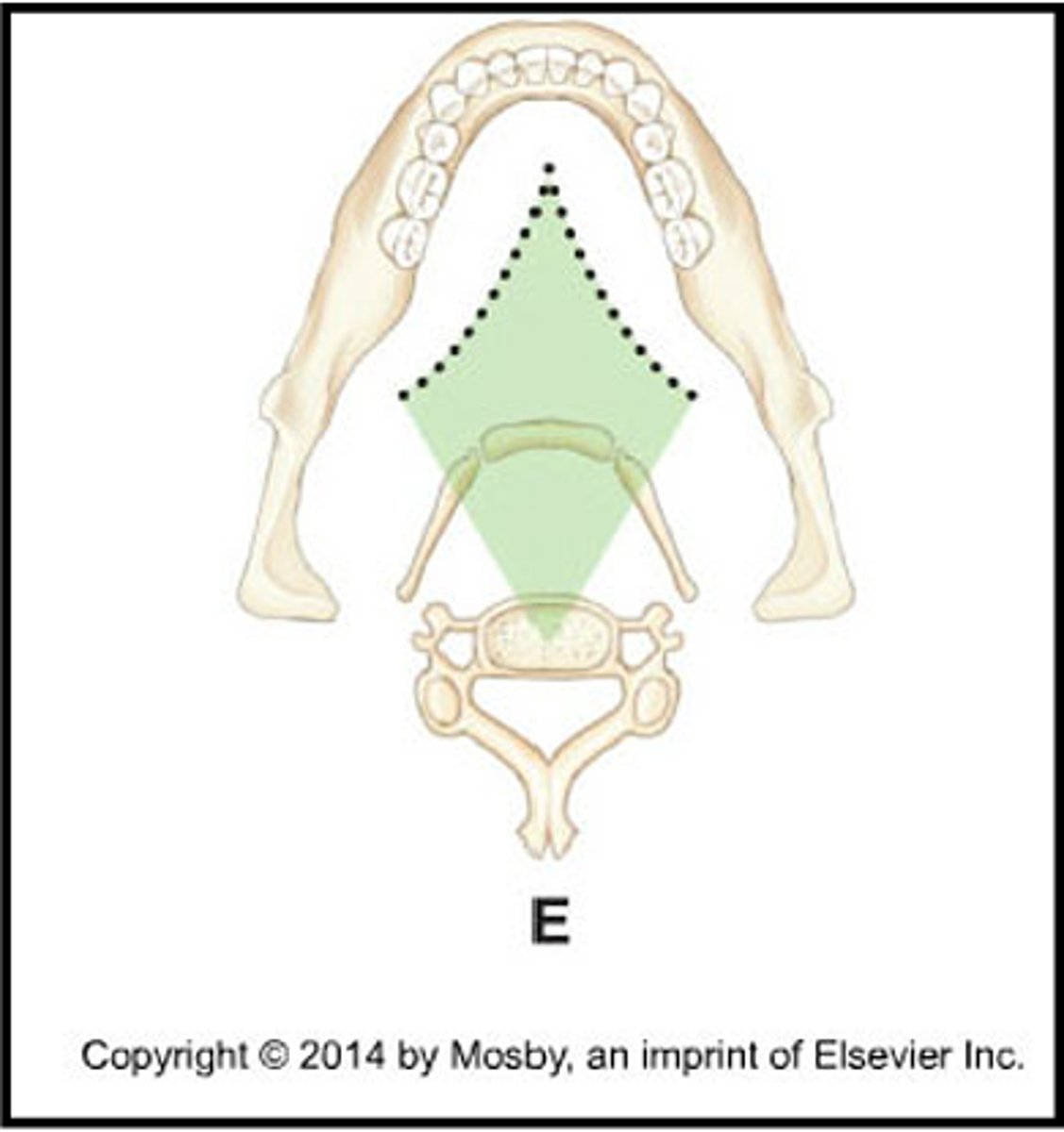 <p>The structures outlined in green indicate what type of image?</p><p>A) real image</p><p>B) double real image</p><p>C) ghost image</p>
