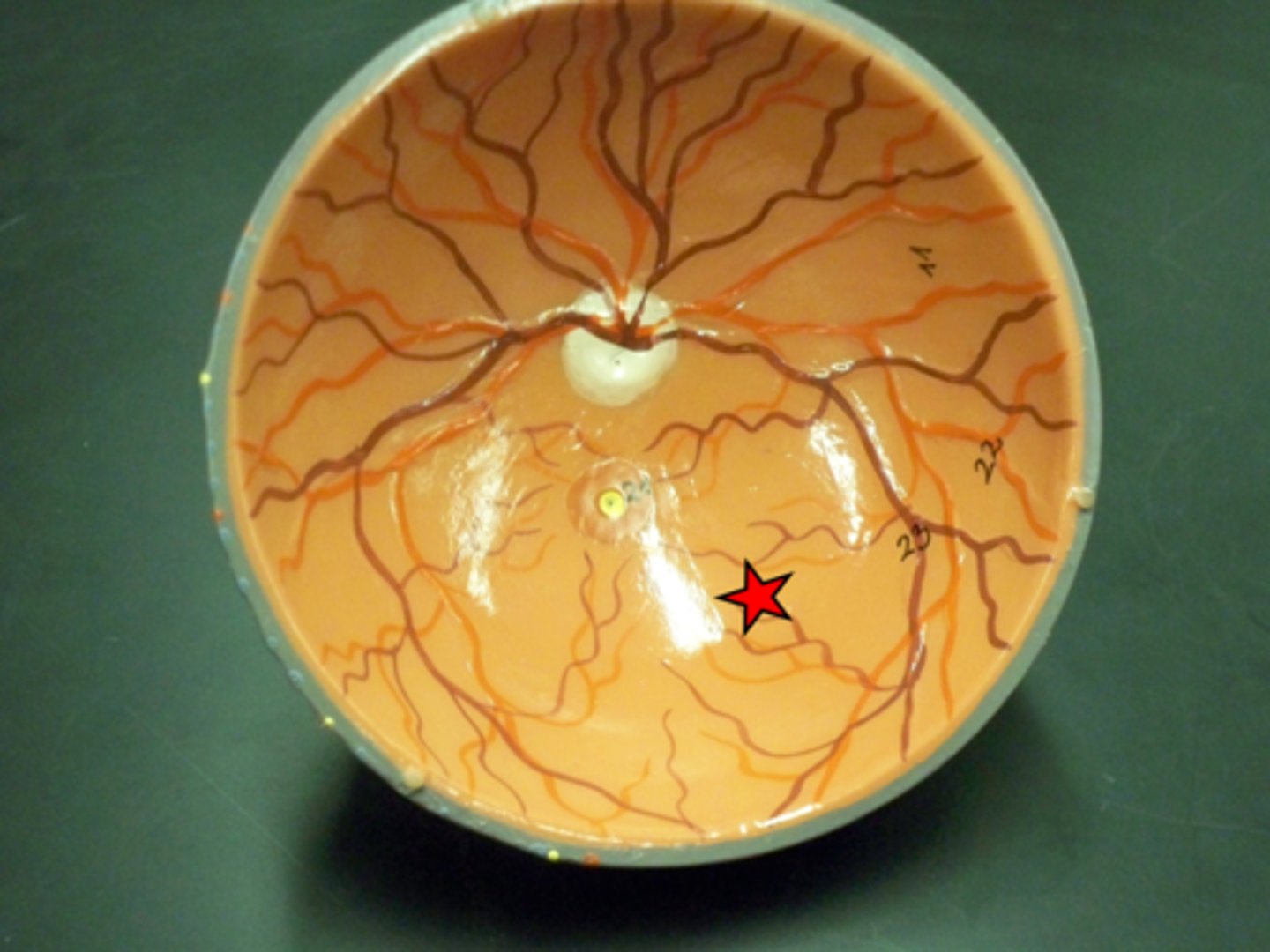 <p>brown neural innermost layer, contains rods and cones</p>