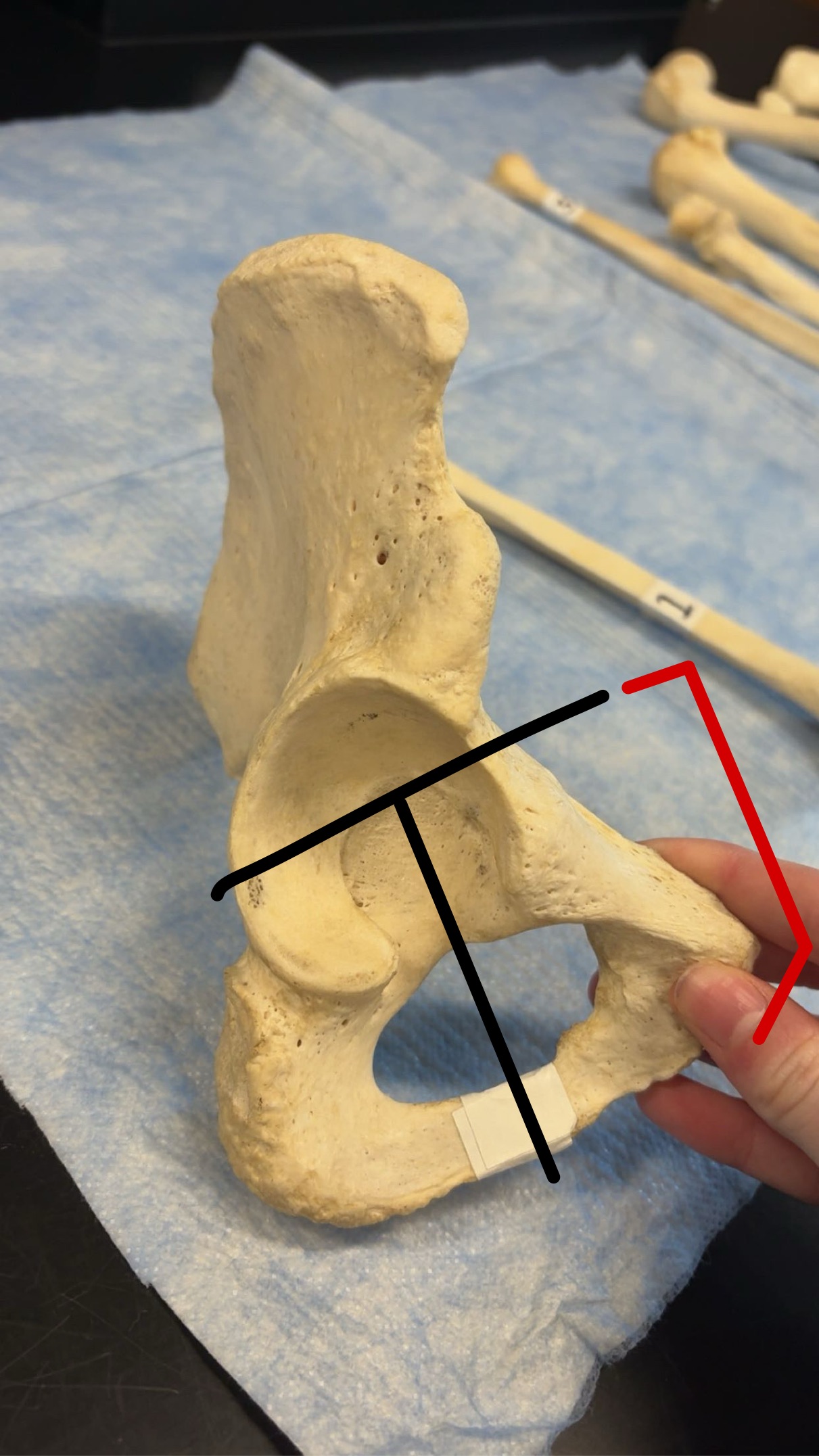 <p>Name this structure</p>