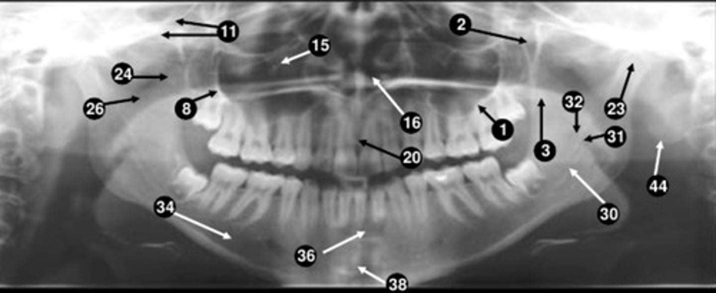 <p>24</p>