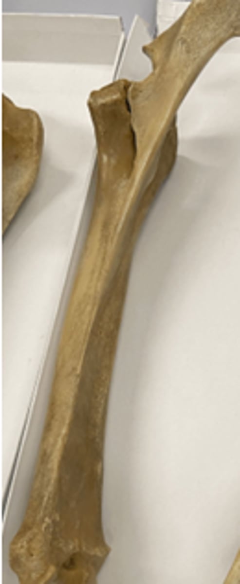 <p>U shape of humerus</p>