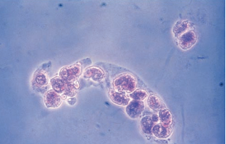 An RTE cast under phase microscopy