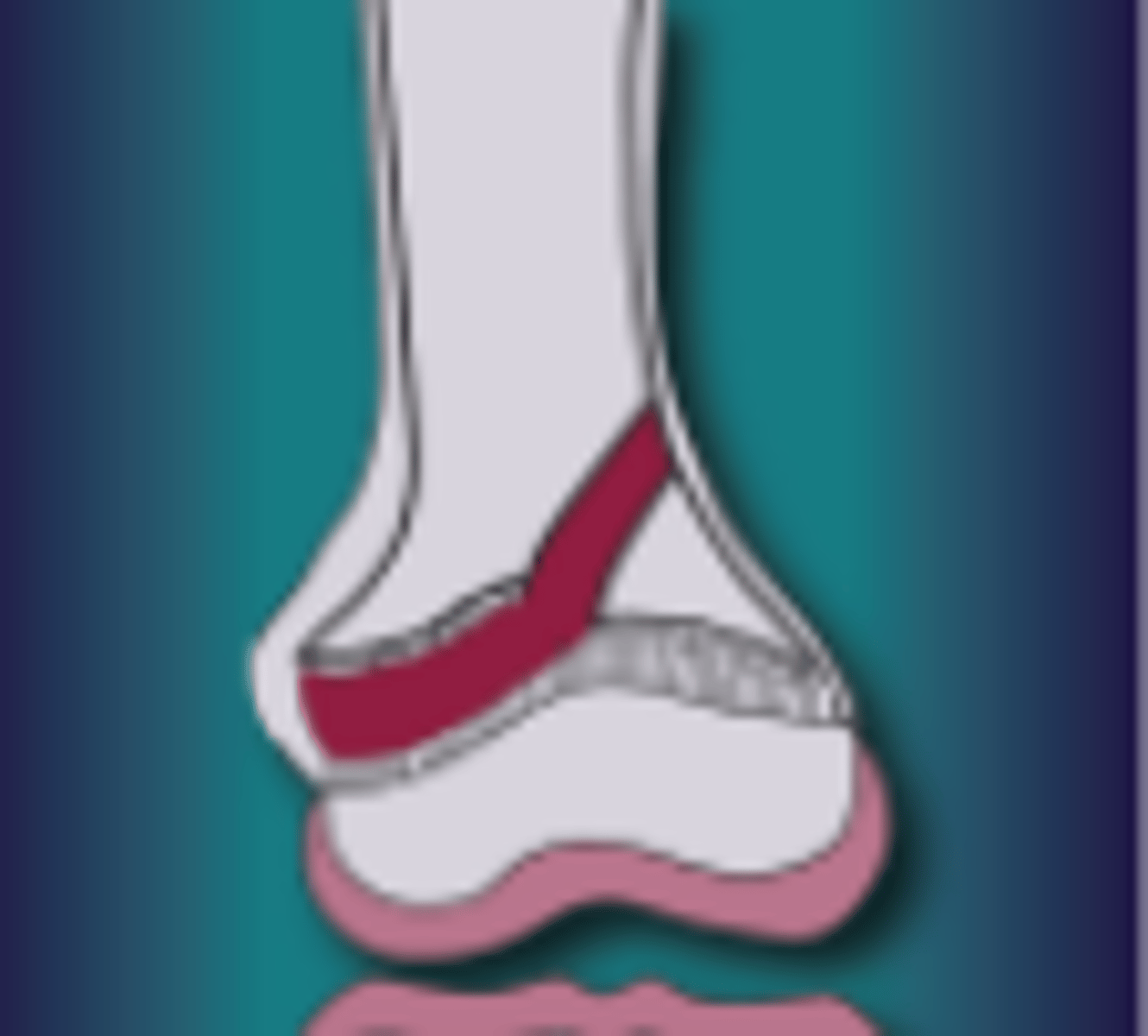 <p>What injury is this</p>