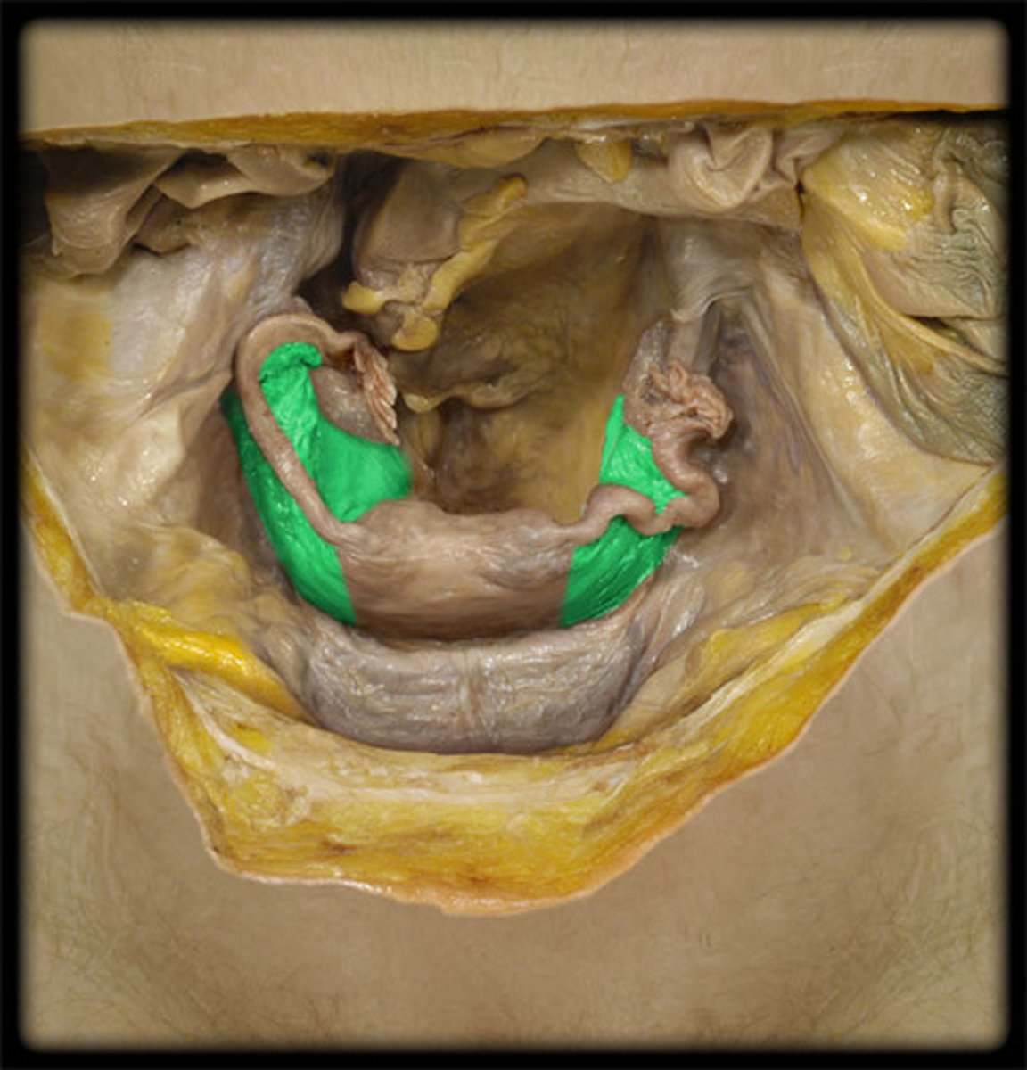 <p>peritoneal fold; supports the uterine (fallopian) tubes, uterus and vagina and encloses the ovarian ligament</p>