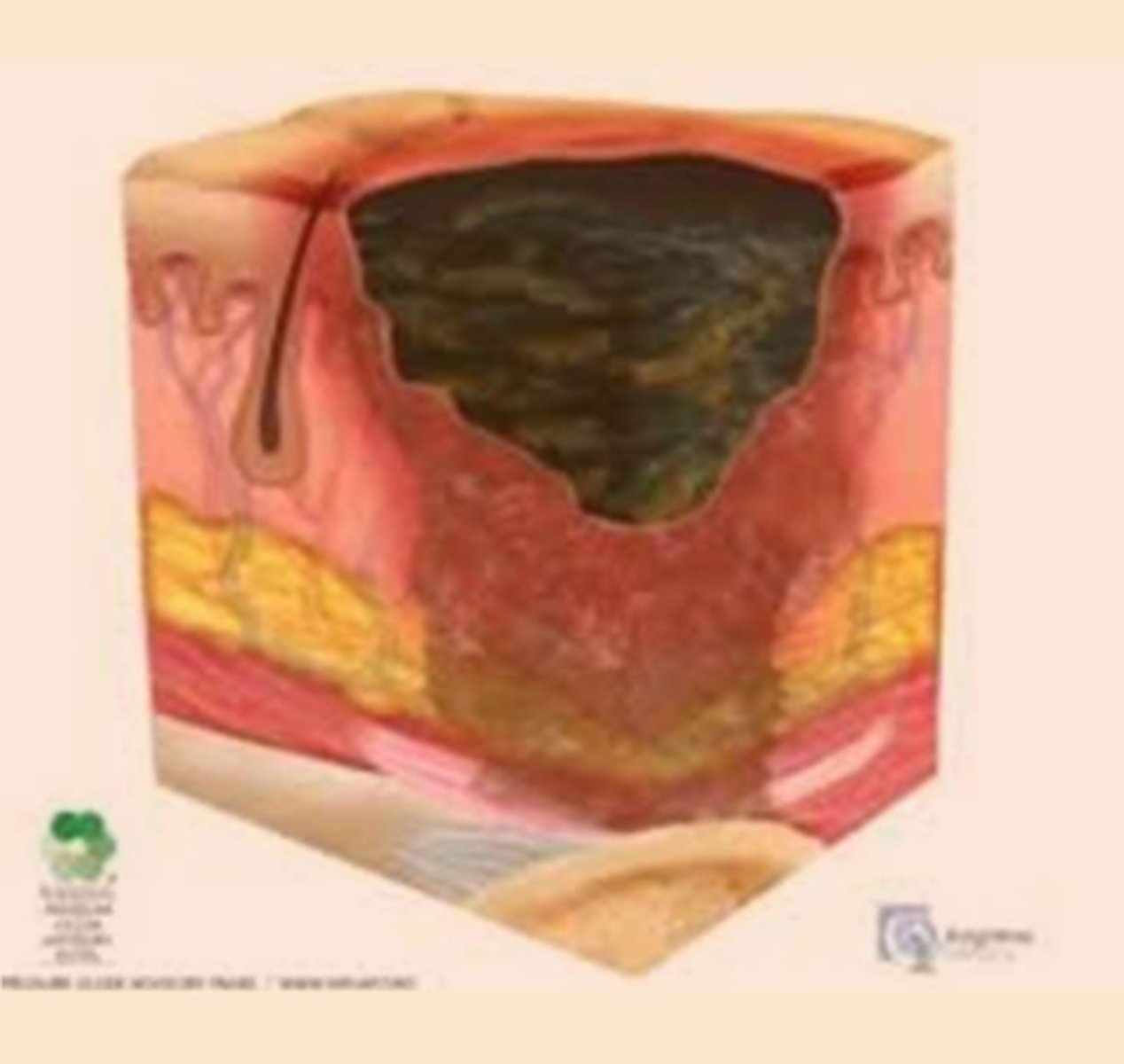 <p>¿lesión?</p><p>¿primaria o secundaria?</p>