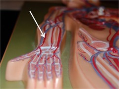 <p>Artery on thumb side of lower arm.</p>