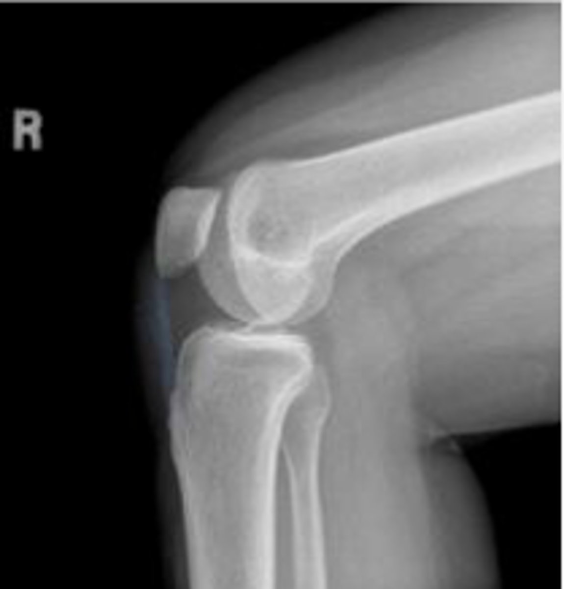 <p>What is outlined?</p>