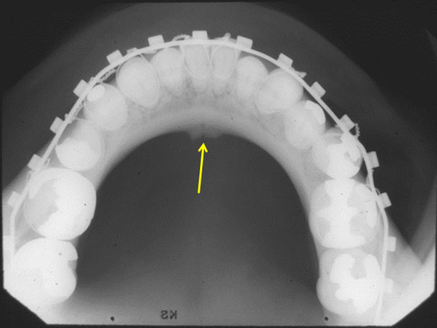 <p>what is this, its description and its appearance on images</p>