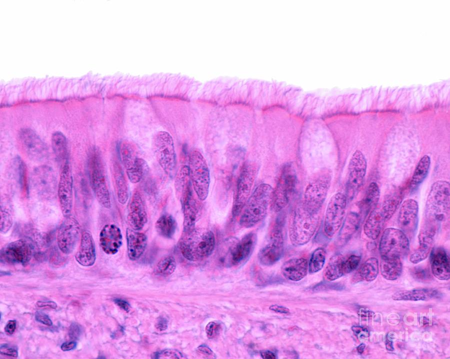 <p>What tissue is this?</p><p>Where is the location?</p><p></p>