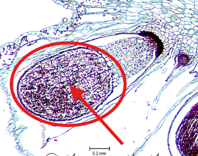 <p>What is contained within the sporangium?</p>