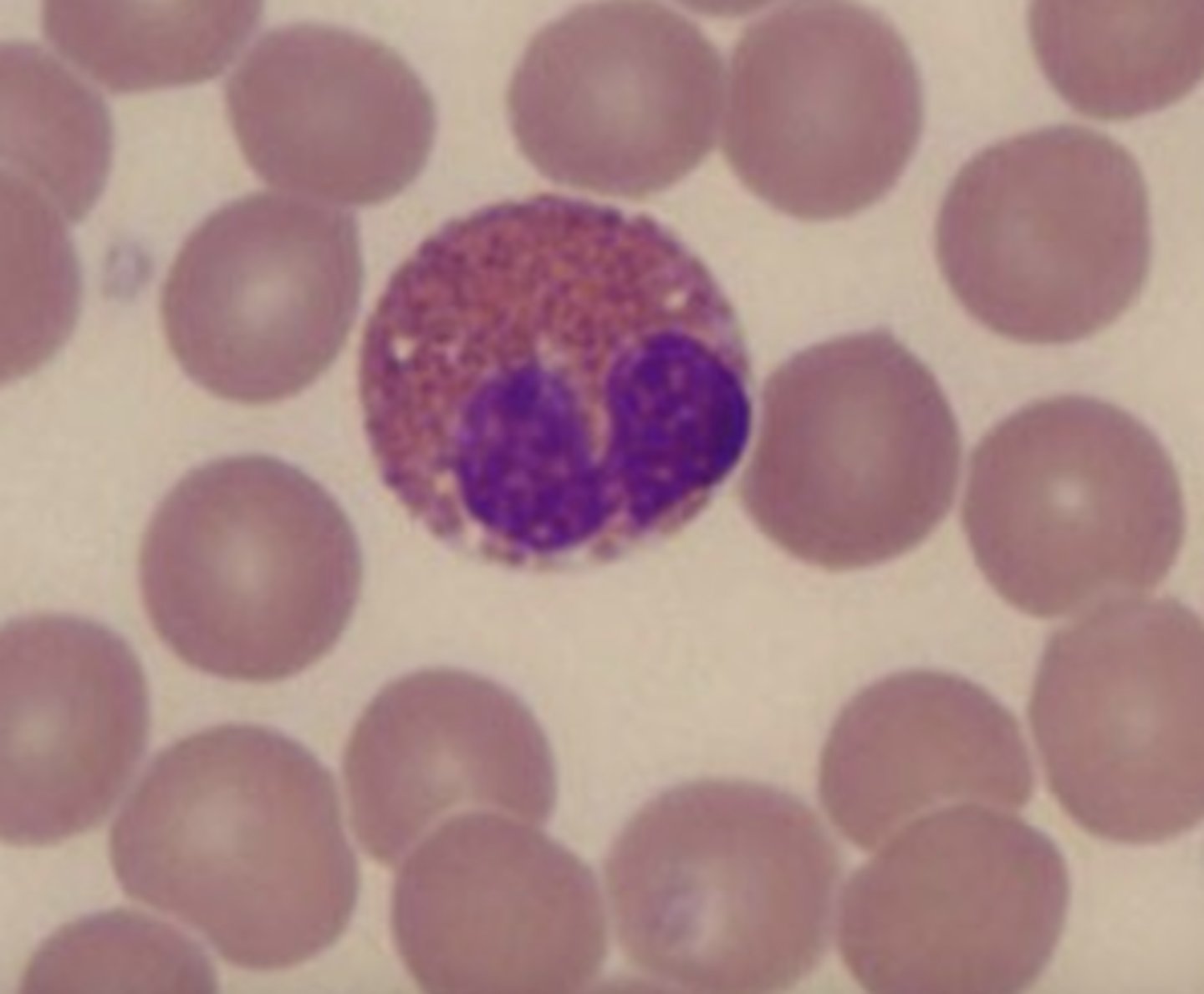 <p>What is the center cell?</p>