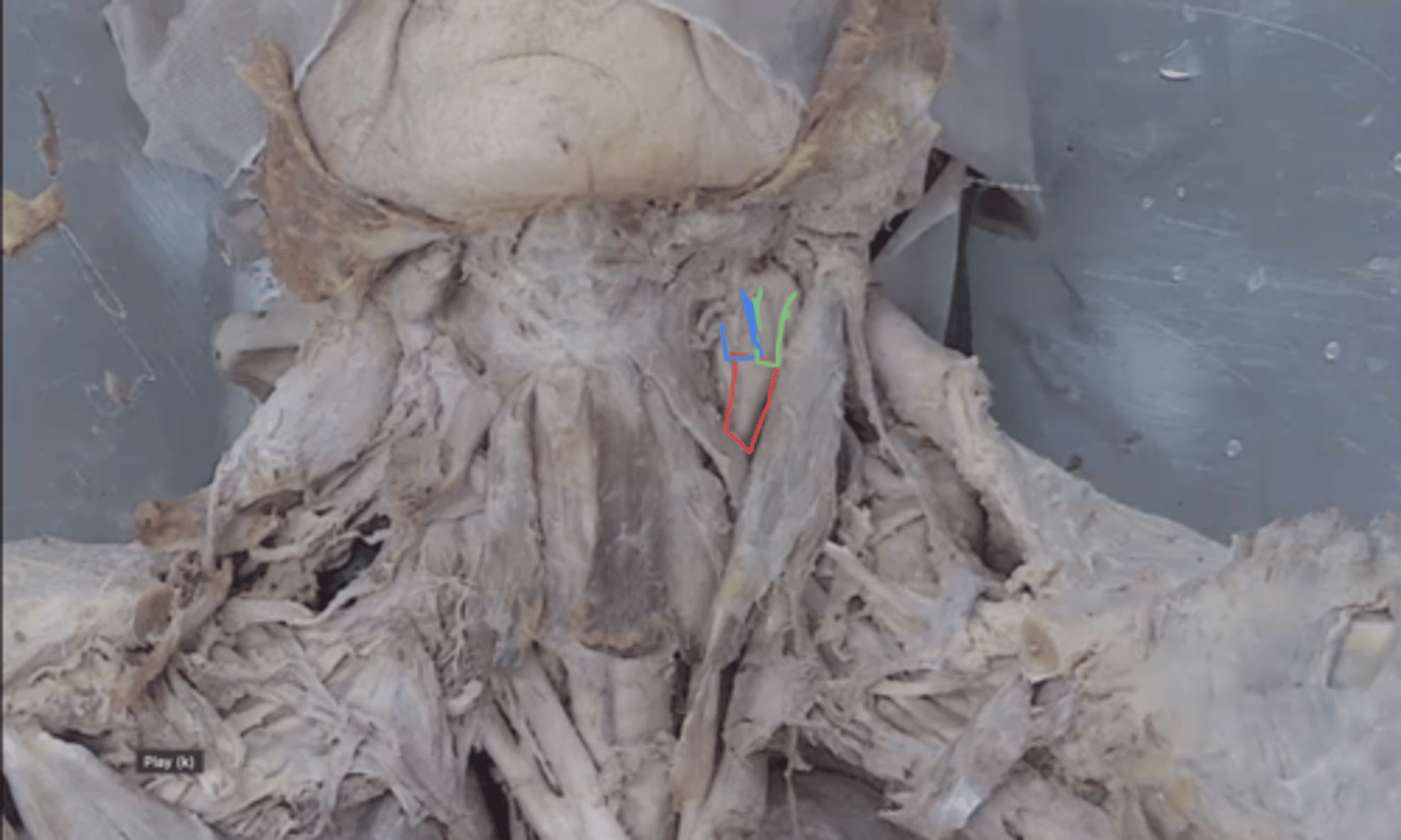 <p>identify structure in red</p>