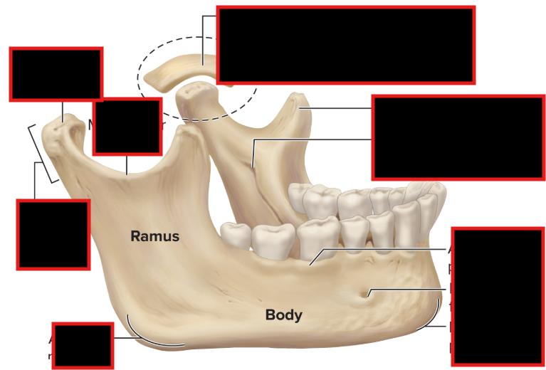 <p>Find the condyalar process</p>