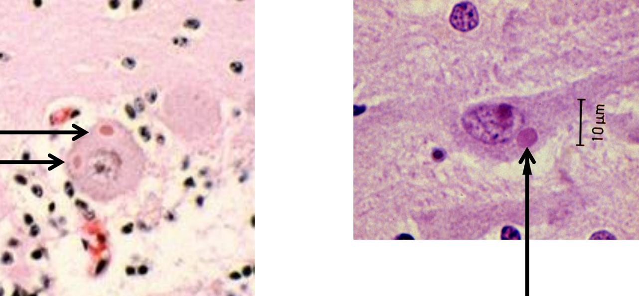 <ul><li><p>cytoplasmic inclusion bodies in nerve cells where viral replication and assembly happens during infection</p></li><li><p>histopathologic signature of rabies but <strong><u>NOT definitive for diagnosis</u></strong> (highly suggestive)</p></li></ul><p></p>