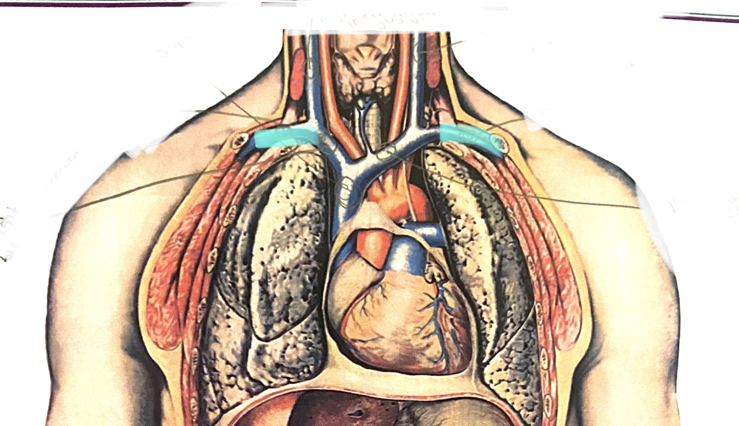 <p>Subclavian vein right and left</p>