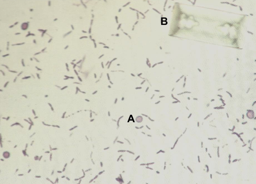 <p>What is A?</p><p>What is B?</p><p>What would you grade this bacteria?</p><p>What is the majority of the sediment present?</p><p>If this was a feline urine sample, would it be primary or secondary disease?</p><p>If this was a canine urine sample, would it be primary or secondary disease?</p>