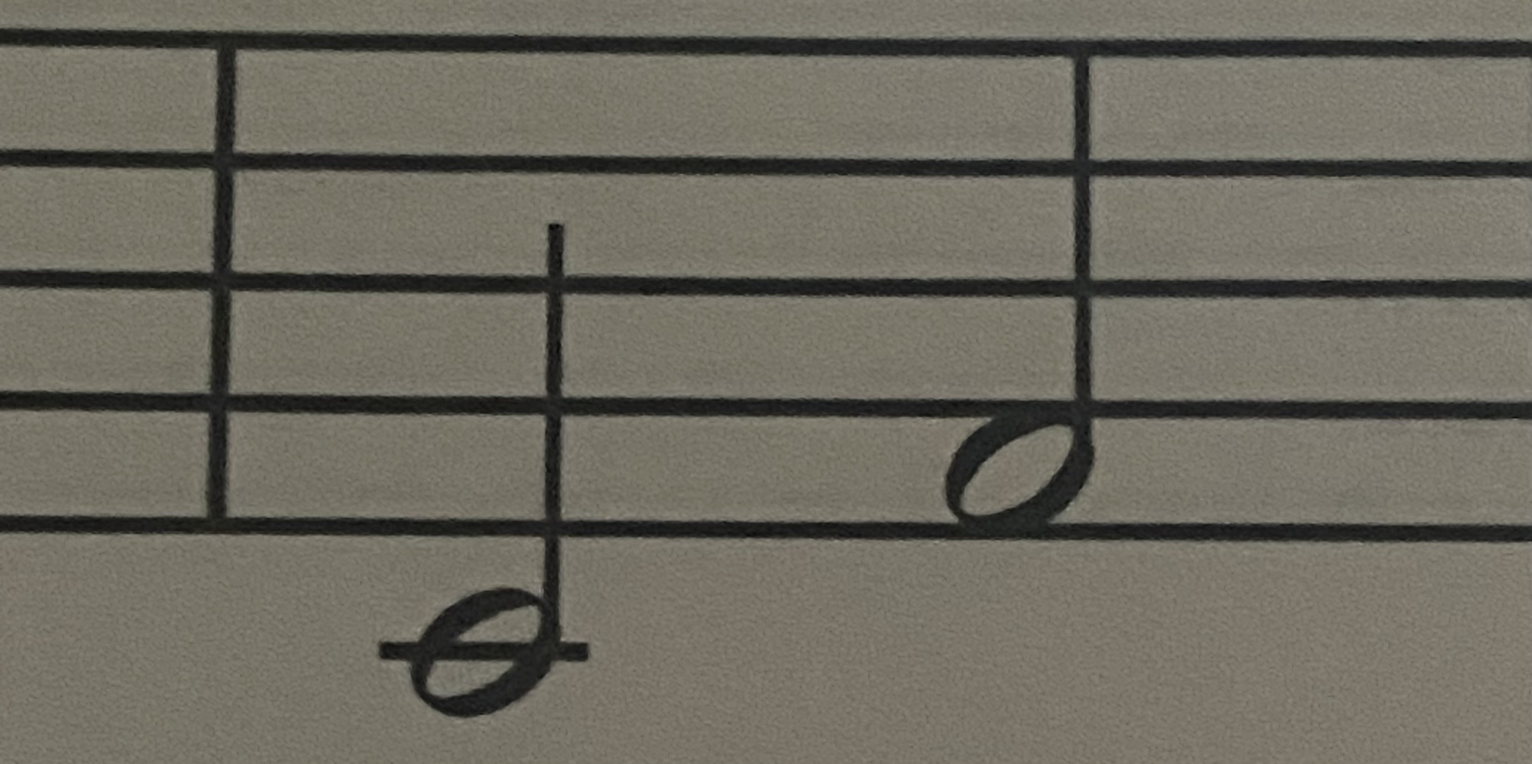 <p>Name the Right Hand Melodic Interval</p>