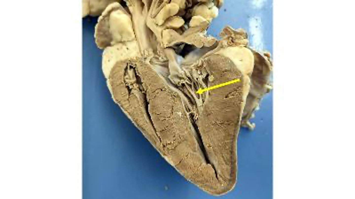 <p>Name the structures</p>