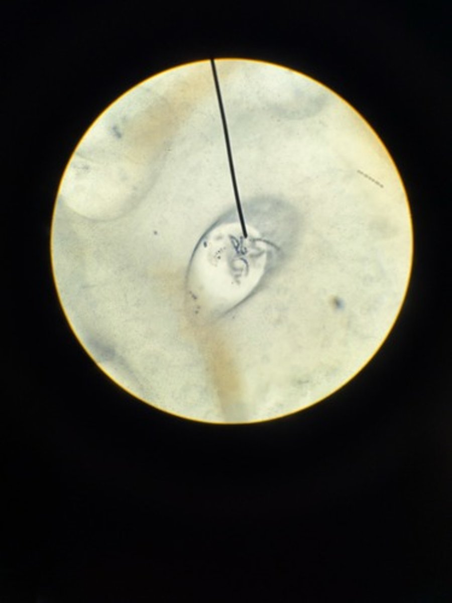 <p>Identify</p>
