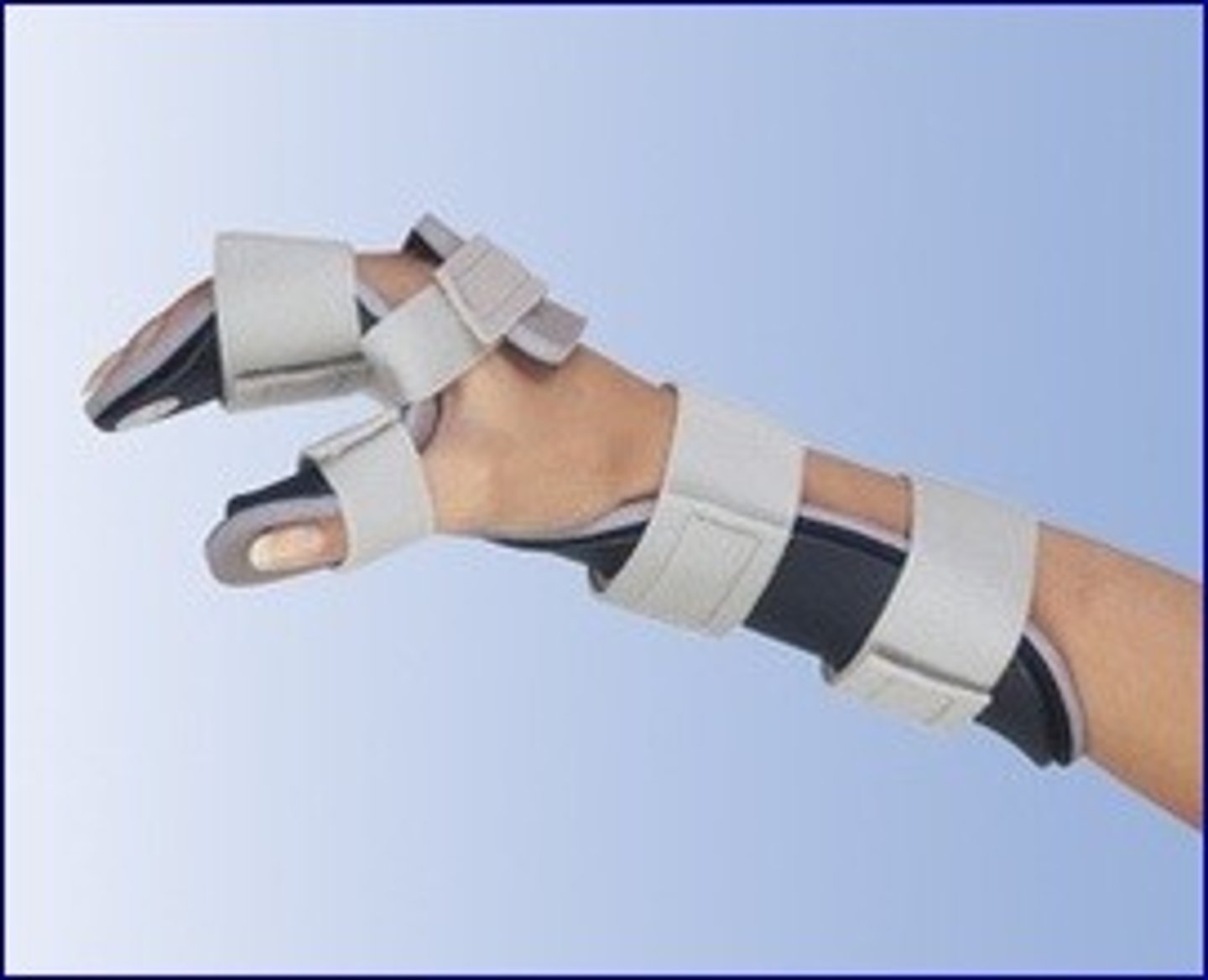 <p>devices that can be used to immobilize injured parts when fractures, dislocations, and other similar injuries are present or suspected</p>