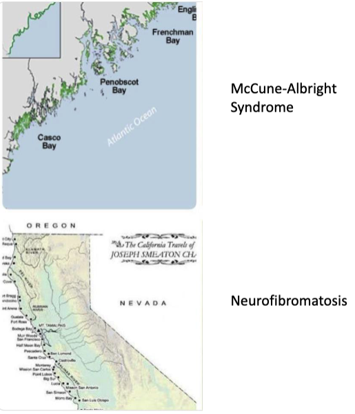 <ul><li><p>McCune-Albright syndrome: irregular margins</p></li><li><p>neurofibromatosis: smooth margins&nbsp;</p></li></ul><p></p>