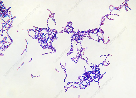 <p>What bacteria is this?</p>