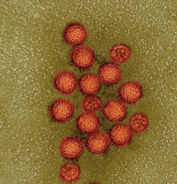 <p>Genus: Norovirus</p>