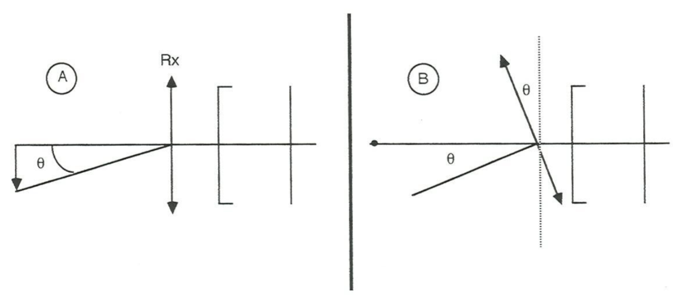 <p>occurs with oblique astigmatism, made of 2 line foci and a COLC</p>