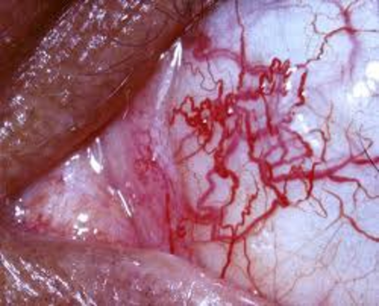 <p>autosomal recessive disorder due to a defect in DNA damage repair leading to defective B- and T-cell functions</p>