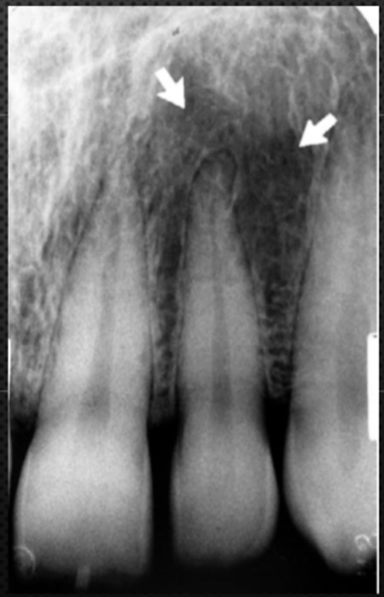 <p>Identify the structure</p>
