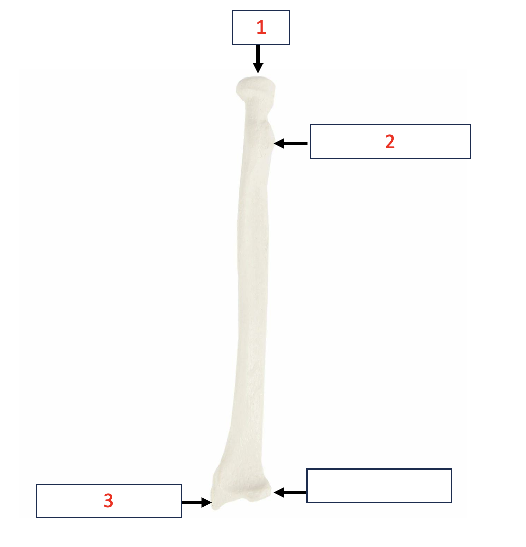 <p>Radius - Radial tuberosity </p>