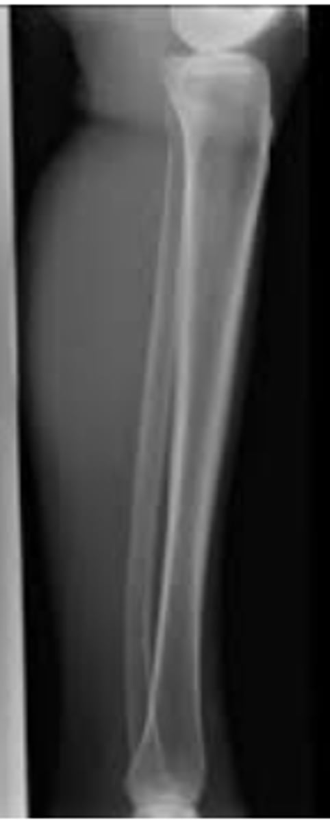 <p>- to include the entire length of the tibia and fibula bones and lateral soft tissue borders. The knee and ankle joint must also be included.</p>
